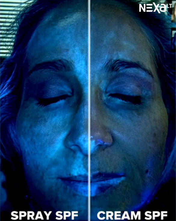 Figure 1 NEXA LT UV Capture from Good Morning America's Melanoma May Segment